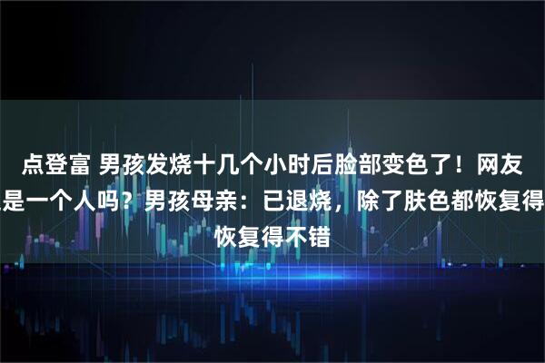 点登富 男孩发烧十几个小时后脸部变色了！网友：这是一个人吗？男孩母亲：已退烧，除了肤色都恢复得不错